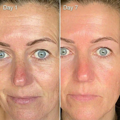 Flancé Retinal Correction Serum